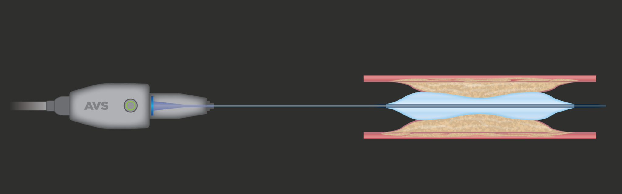 Mechanism of Action - AVS Pulse, Inc